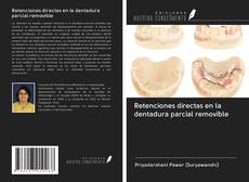 Bookcover of Retenciones directas en la dentadura parcial removible