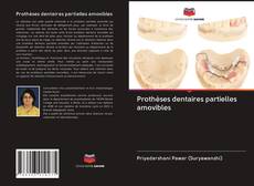 Borítókép a  Prothèses dentaires partielles amovibles - hoz