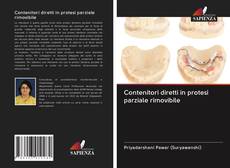Bookcover of Contenitori diretti in protesi parziale rimovibile