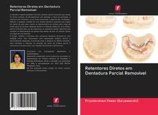 Retentores Diretos em Dentadura Parcial Removível kitap kapağı