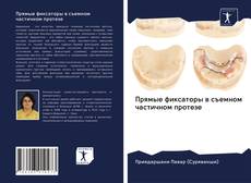 Bookcover of Прямые фиксаторы в съемном частичном протезе