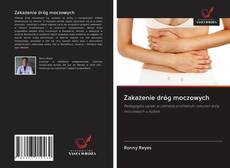 Buchcover von Zakażenie dróg moczowych