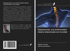 Bookcover of Osteoporosis: una enfermedad clásica relacionada con la edad