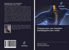 Обложка Osteoporose: een klassieke leeftijdsgebonden ziekte