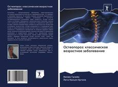 Couverture de Остеопороз: классическое возрастное заболевание