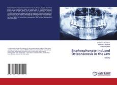 Buchcover von Bisphosphonate Induced Osteonecrosis in the Jaw