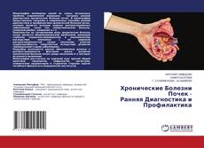 Copertina di Хронические Болезни Почек - Ранняя Диагностика и Профилактика