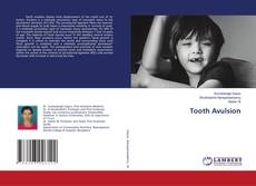 Buchcover von Tooth Avulsion
