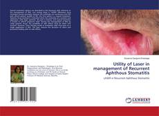 Copertina di Utility of Laser in management of Recurrent Aphthous Stomatitis