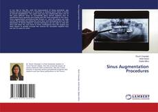 Copertina di Sinus Augmentation Procedures