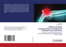 Buchcover von Effects of Silver nanoparticles on healing of infected fractured bone