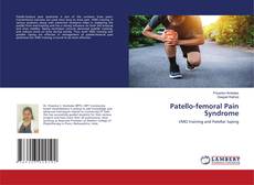 Buchcover von Patello-femoral Pain Syndrome