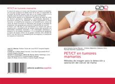 Обложка PET/CT en tumores mamarios