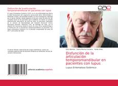 Disfunción de la articulación temporomandibular en pacientes con lupus kitap kapağı