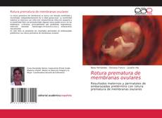 Capa do livro de Rotura prematura de membranas ovulares 