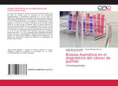 Обложка Biopsia Aspirativa en el diagnóstico del cáncer de pulmón