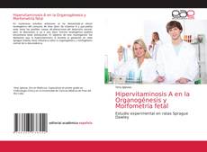Capa do livro de Hipervitaminosis A en la Organogénesis y Morfometría fetal 