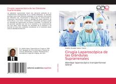 Cirugía Laparoscópica de las Glándulas Suprarrenales的封面