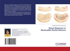 Buchcover von Direct Retainers in Removable Partial Denture
