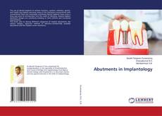 Buchcover von Abutments in Implantology