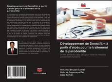 Bookcover of Développement de Dentalfilm à partir d'aloès pour le traitement de la parodontite