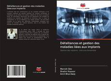 Bookcover of Défaillances et gestion des maladies liées aux implants