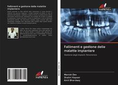 Bookcover of Fallimenti e gestione delle malattie implantare