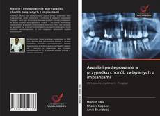 Buchcover von Awarie i postępowanie w przypadku chorób związanych z implantami