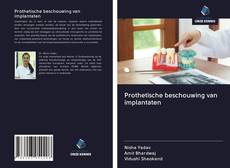 Prothetische beschouwing van implantaten的封面