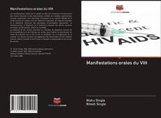 Buchcover von Manifestations orales du VIH