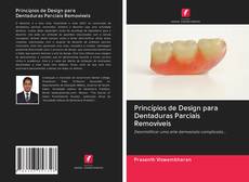 Capa do livro de Princípios de Design para Dentaduras Parciais Removíveis 