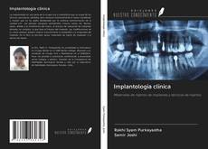 Buchcover von Implantología clínica