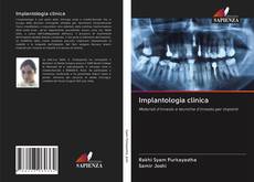Capa do livro de Implantologia clinica 