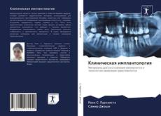 Bookcover of Клиническая имплантология