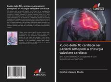 Bookcover of Ruolo della TC cardiaca nei pazienti sottoposti a chirurgia valvolare cardiaca