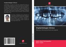 Implantologia Clínica kitap kapağı