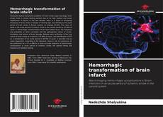 Bookcover of Hemorrhagic transformation of brain infarct