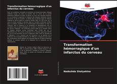 Borítókép a  Transformation hémorragique d'un infarctus du cerveau - hoz