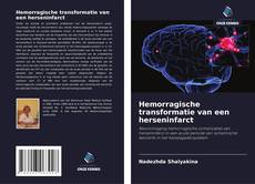 Copertina di Hemorragische transformatie van een herseninfarct