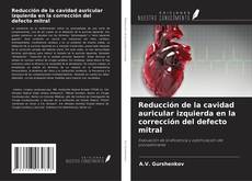 Reducción de la cavidad auricular izquierda en la corrección del defecto mitral kitap kapağı