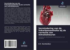 Couverture de Vermindering van de linkerboezemholte bij de correctie van mitraliskleuren