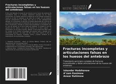 Bookcover of Fracturas incompletas y articulaciones falsas en los huesos del antebrazo