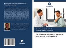 Buchcover von Kalzifizierte Schulter-Tendinitis und fokale Schockwelle