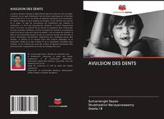 Bookcover of AVULSION DES DENTS