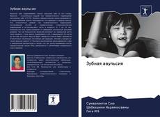 Couverture de Зубная авульсия