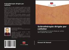 Bookcover of Sclérothérapie dirigée par cathéter