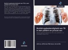 Copertina di Multidrugsbestendigheid van TB in een patiënt en proces van