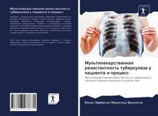 Portada del libro de Мультилекарственная резистентность туберкулеза у пациента и процесс