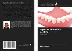 Bookcover of Agentes de unión a dentina