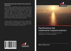 Bookcover of Pianificazione del trattamento Impianti anteriori